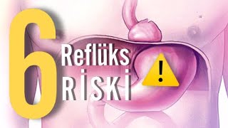 Refküks və 6 risk faktoru hansılardır? #reflux #reflü mob:0505508882