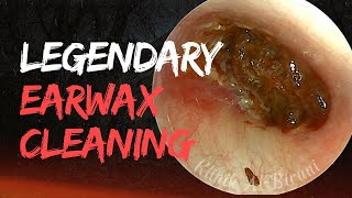 Legendary Level Of Earwax Cleaning🔥