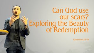 Can God Use Our Scars? Exploring the Beauty of Redemption" (May 5th, 2024)