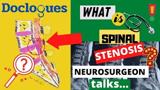 What is Spinal Stenosis? Listen to Neurosurgeon!