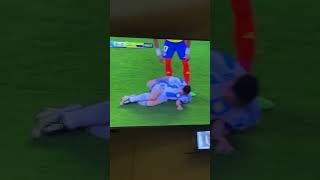 Messi 2nd injury copa America final #messi #youtube #shorts #viral #fyp #football #subscribe