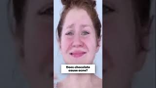 Does Chocolate cause Acne?😢 Dr.Mike