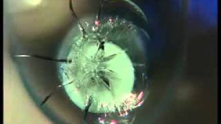 SMART Repair   Compressin and vacuum of windshield crack repair