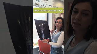 Boy zonaları, sümük yaşı