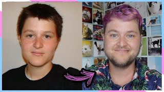 12 YEARS ON TESTOSTERONE | FTM TRANSGENDER