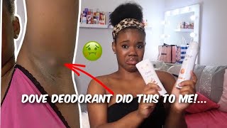 WHY I STOPPED USING DOVE DEODORANT *UPDATED ARMPIT HYGIENE* + ARMPIT HORROR STORY W/ PICS!