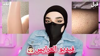 العروسة لازم تشوف الفيديو👰🏻كيف نتخلص من جلد الوزة والشعر المزعج النايم تحت الجلد💫كيف نخلي جسمنا يلمع