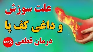 علت سوزش و داغی کف پا چیست؟! | درمان خانگی داغی کف پا