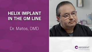 Helix Implant in the GM Line | Dr. Matos