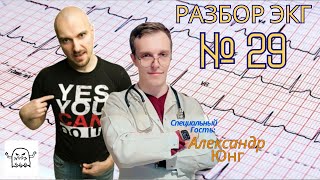 Разбор ЭКГ № 29