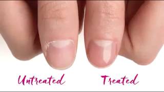 Dr Dana Nail renewal system