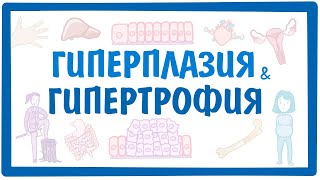 ГИПЕРПЛАЗИЯ И ГИПЕРТРОФИЯ