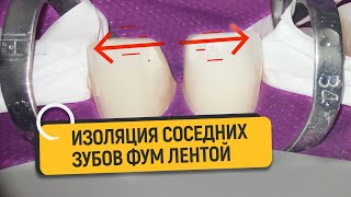 Как просто изолировать соседние зубы? Изоляция фум лентой | Лайфхак #7