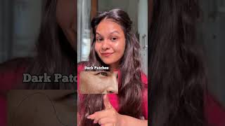 How to Treat Hyperpigmentation & Tanning || Part 3 || Indian Pharmacy ✨#viral #ashortaday