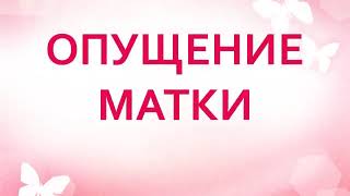 опущение матки