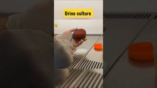 urine culture #shorts