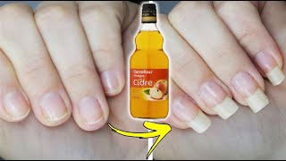 Astuce au vinaigre pour renforcer et faire pousser les ongles