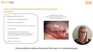 Akuutin haavan paraneminen (Moduuli 5) – 15 minuutin versio | Wound Club Online