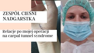 Zespół Cieśni Nadgarstka - relacje po operacji. Carpal tunnel syndrome