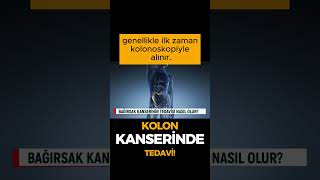 Kolon kanserinde tedavi nasıl olur? #shortsvideo