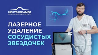 Лазерное удаление сосудистых звездочек