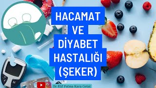 Şeker Hastaları (#Diyabet) #Hacamat Tedavisi Olabilir mi?