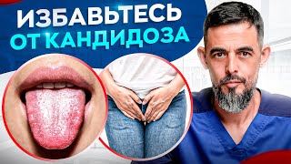 4 способа избавиться от молочницы РАЗ и НАВСЕГДА!