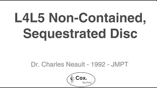 Cox® Technic Treated L5S1 Disc Herniation and Fragment for Relief