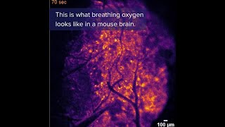 NEW #research uses a protein related to a firefly's glow to see #oxygen in the #brain. #science