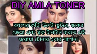 DIY Amla Toner :বয়সের কাঁটা উল্টো ছুটবে,ত্বকের জেল্লা বাড়াতে,ত্বক টানটান করতে এই টোনার ২বার লাগান।