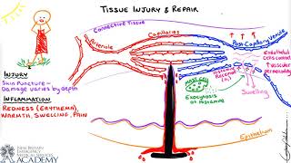 Tissue Injury & Repair