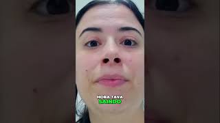 Facetas Dentárias: O Que Você Precisa Saber Antes de Colocar