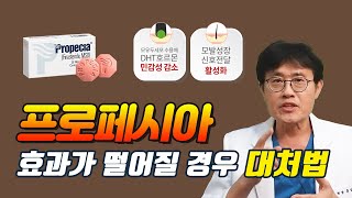 프로페시아 효과가 떨어질 경우 대처법