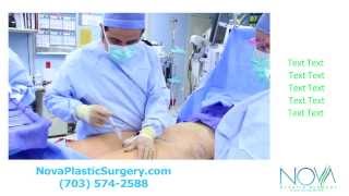 Liposuction Procedure performed by Dr. Fadi Nukta at NOVA Plastic Surgery in Virginia