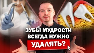 ВСЕ о зубах мудрости. Всегда нужно удалять зубы мудрости? Зубы мудрости удаление