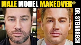 Male Model Makeover Featuring Zack | Male Plastic Surgery