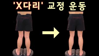 X다리 교정운동‼️ 발목 모양 꼭 체크하세요