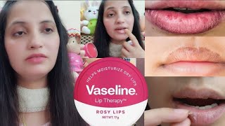 Vaseline Lip Therapy Moisturizer for dry, chapped lips 👄 Pinks lips || My Honest review