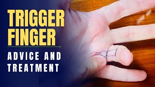 Trigger Finger Advice and Treatment