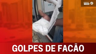 Homem tenta socorrer vizinha agredida e é vítima de G0LP3S de facão