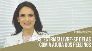 O peeling e se efeito no tratamento das estrias!