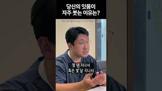 자주 붓는 잇몸엔 이유가 있다