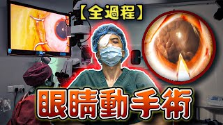 【手术全过程】人生中第一次眼睛动手术！近视手术的真实体验?!?!