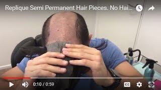 Replique Sydney Semi Permanent Hair Pieces. No Hair Transplant required!