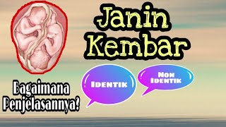 Kehamilan Kembar - Apa saja Resikonya ???