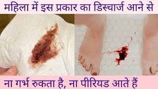 सावधान हो जाओ 😱 अगर इस तरह का डिस्चार्ज आ रहा है | Brown Discharge | Reasons and Home Remedies