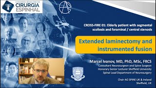 Open decompression versus MIS or indirect spinal decompression - 2021 Brasil-EANS-NASS Congress