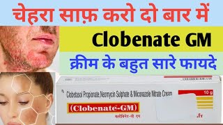 Clobenate gm Cream kis kaam aati hai | Clobenate gm