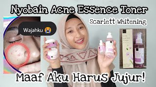 Acne Essense Toner Scarlett Untuk Wajah Berjerawat | MAAF AKU HARUS JUJUR!