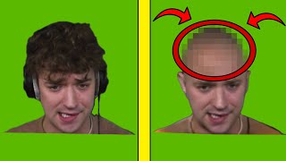 Crainer Is Bald?